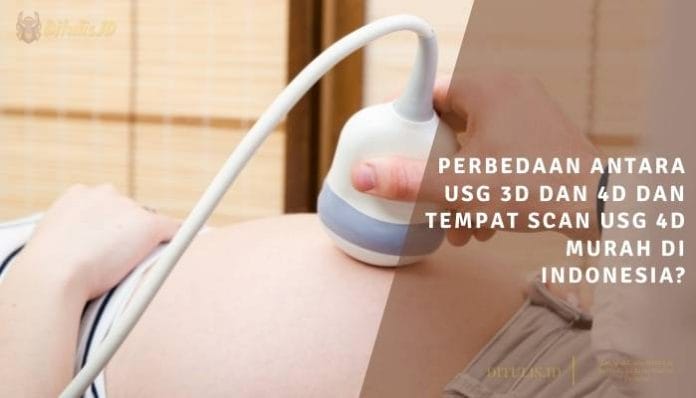 perbedaan antara usg 3d dan 4d dan tempat scan usg 4d murah di indonesia